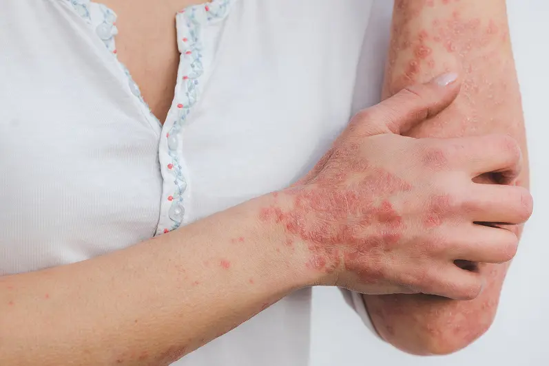 D: Dermatology