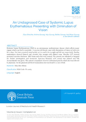 An Undiagnosed Case of Systemic Lupus Erythematosus Presenting with Diminution of Vision