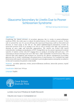 Glaucoma Secondary to Uveitis Due to Posner Schlossman Syndrome